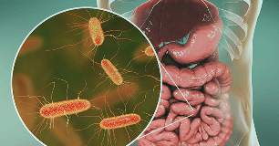 Parasitic Gut Infections