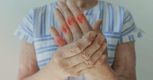 Hand & Finger Osteoarthritis