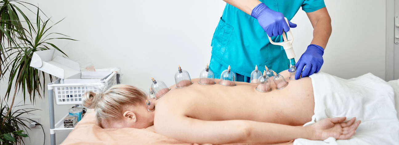  Certified practitioner performing therapeutic wet cupping (Hijama) on a client's back for pain relief.