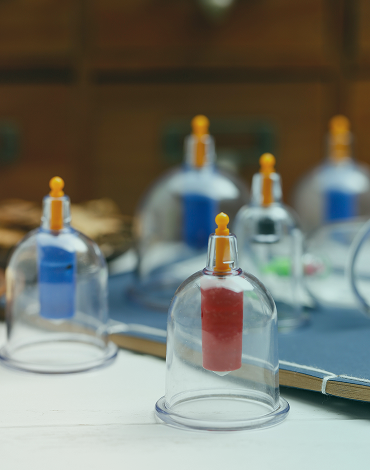 Cupping